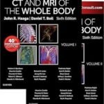 CT and MRI of the Whole Body by John R. Haaga